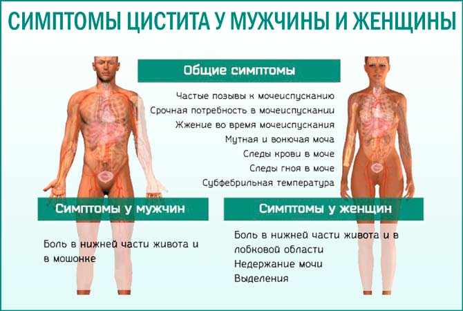 симптомы цистита