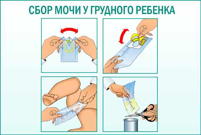 правила сбора мочи