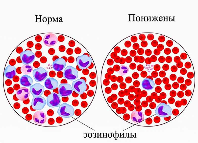 рзличные уровни эозинофилов