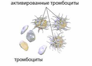 тромбоциты стандартрные и активированные