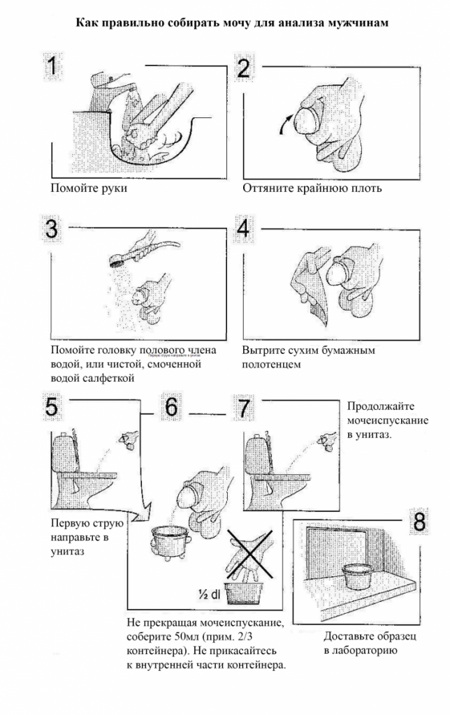 сбор анализа мочи мужчине