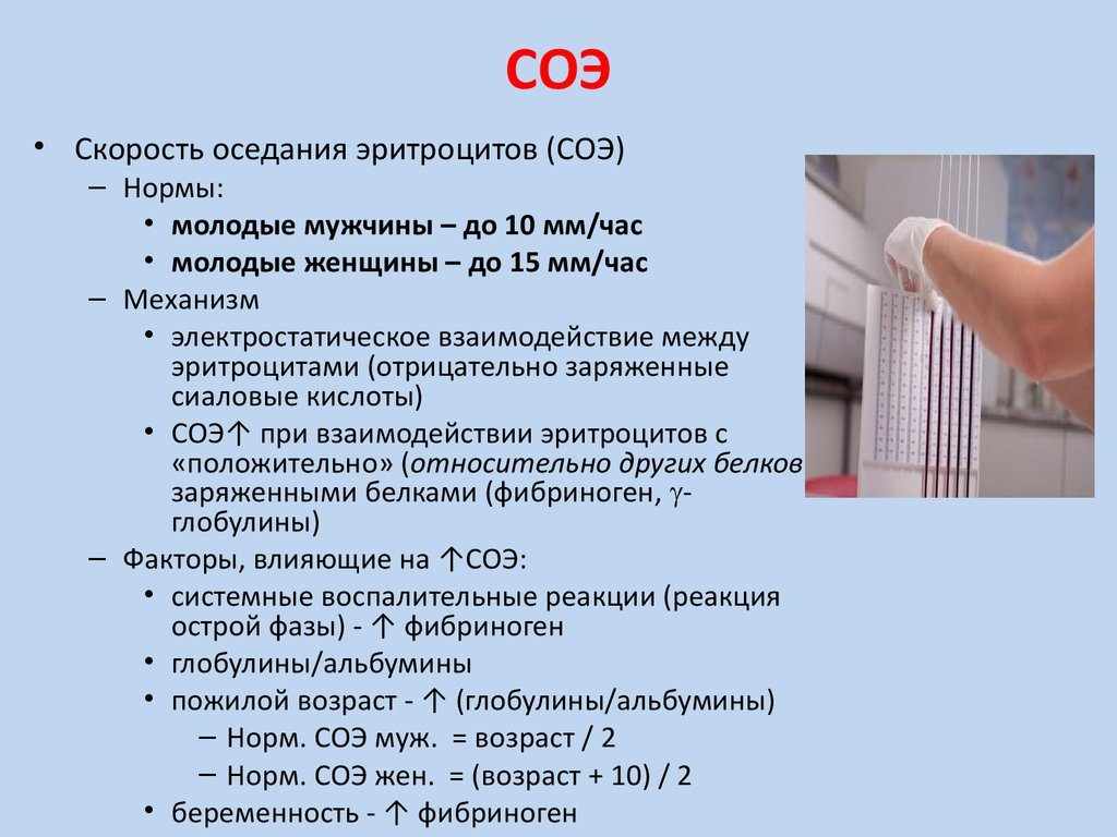 расшифровка анализа СОЭ