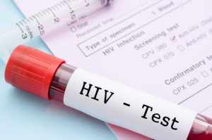 пробирка с анализом крови на СПИД