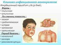 развитие мононуклеоза у детей