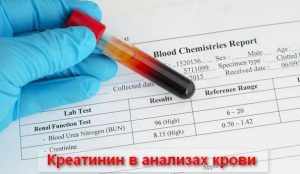 сданный анализ на креатинин 