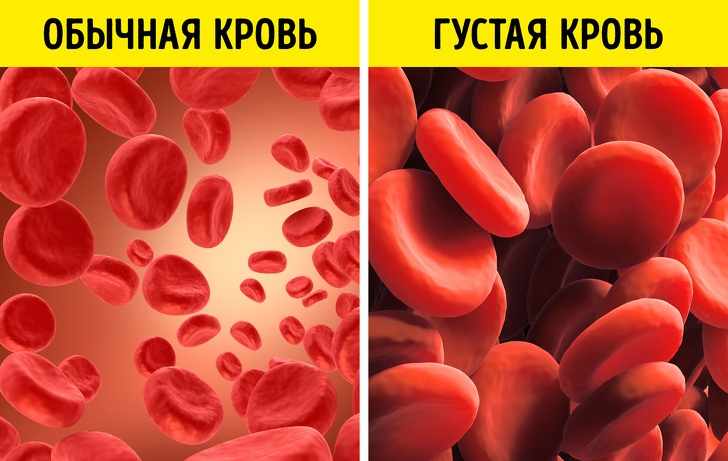 на фото обычная и густая кровь