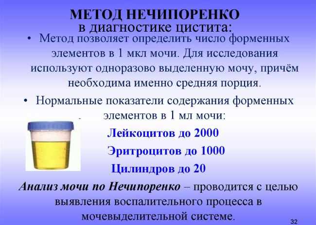 анализ мочи по Нечипоренко