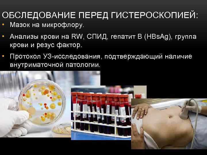 анализы и гистероскопия