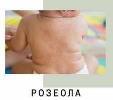 розеола у ребенка