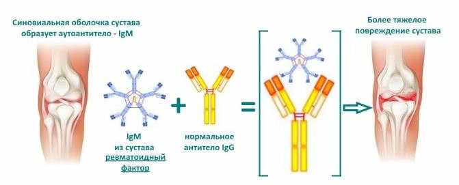 ревмофактор анализ крови 