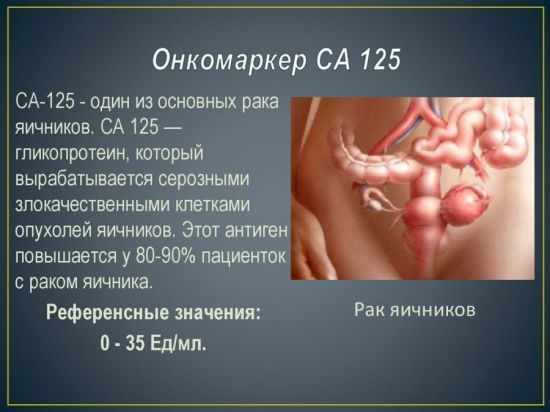 значение маркера СА 125