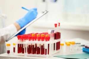 изучение анализа крови в лаборатории