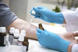 Кожное тестирование – наиболее точный метод определения чувствительности организма к аллергенам