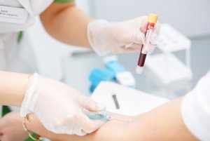 Процедура забора крови для исследования уровня РЭА