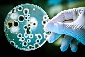 Уреаплазмы - мельчайшие бактерии, которые вызывают уреаплазмоз
