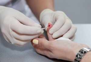 Для клинического анализа крови необходимо сдать капиллярную кровь из пальца 
