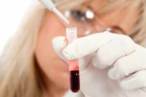 Анализ крови на токсоплазмоз: норма и отклонение от нормы 
