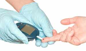 Диагностика сахара в крови: норма и отклонение 