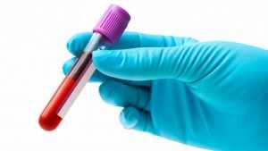 Анализ крови – эффективная лабораторная диагностика состояния организма 