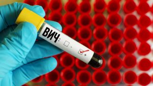 ВИЧ-инфекция диагностируется с помощью анализа крови