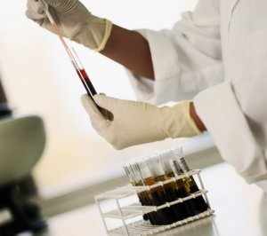WBC – обозначение лейкоцитов в анализе крови