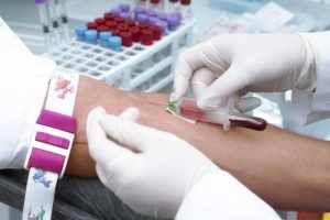 Правильная подготовка к анализу крови на СОЭ – залог достоверного результата 