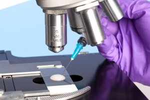 Анализ используется для установления фертильности мужчин и выявления половых заболеваний