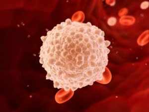 Высокий уровень лейкоцитов в крови может быть признаком лейкоза