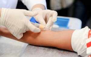 Процедура забора крови на иммунологическое исследование