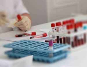 Биохимический анализ крови – эффективная лабораторная диагностика состояния печени