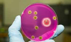 Бактериологическое исследование - эффективный метод диагностики стрептококковой инфекции 