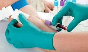 Правильная подготовка на анализ крови РВ 