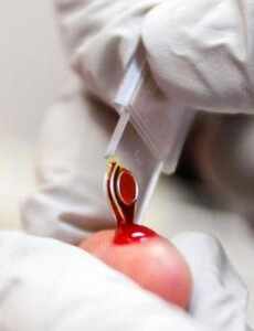 Подготовка к анализу крови 