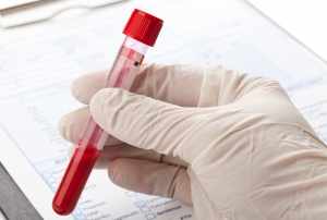 Гемоглобин – это красный железосодержащий пигмент крови человека