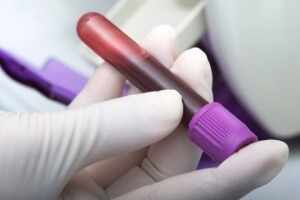 Расшифровка анализа - норма показателя в крови