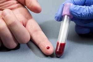Правильная подготовка к анализу крови на гемоглобин – залог достоверного результата 
