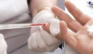 Процедура забора крови для исследования уровня эритроцитов