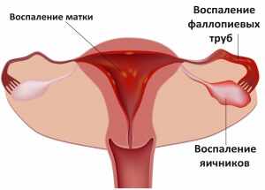 Самые распространенные причины возникновения заболевания 