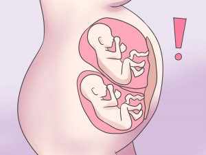 Высокий уровень гормона может указывать на многоплодную беременность
