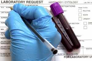 Расшифровка анализа крови РПГА