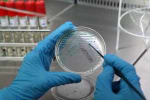 Мазок на флору – бактериологическое исследование соскоба взятого с разных мест