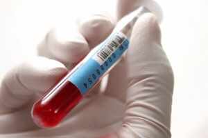 Анализ крови на токсоплазмоз – самая эффективная диагностика заболевания