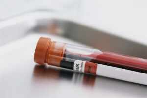 Факторы которые влияют на результат анализа крови 