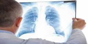 диагноз бронхиальной астмы
