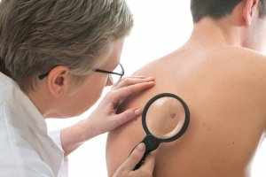 Рак кожи – это злокачественное заболевание