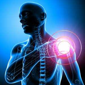 Асептический некроз головки плечевой кости может быть вызван разными причинами и факторами