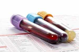 Сдаем кровь на биохимию для определения уровня и активности ферментов
