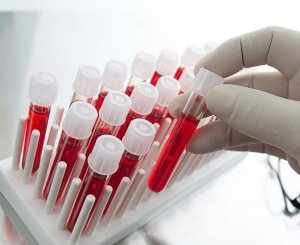Чтобы нормализовать уровень лимфоцитов в крови нужно найти причины их повышения