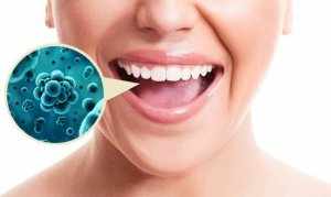Нарушение баланса микрофлоры полости рта может приводить к кариесу, стоматиту и прочим заболеваниям