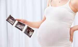 Во время беременности женщине нужно сделать три УЗИ, по одному в каждом триместре